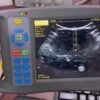 5.8" Handheld Ultrasound Scanner